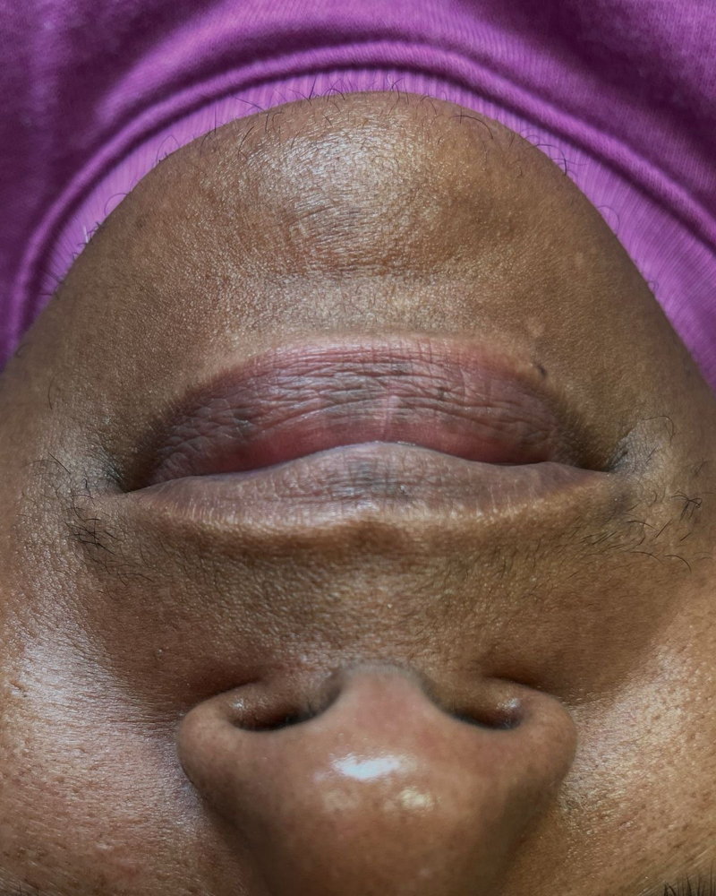 Chin Wax