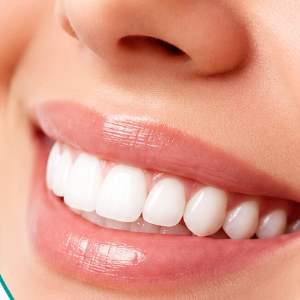 Teeth Whitening at Lifted Autumn in El Paso, TX