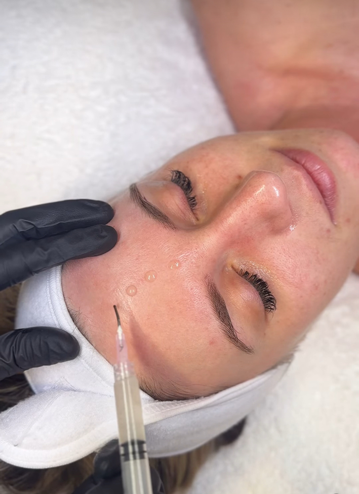FACTORFIVE RDS StemCell Peel