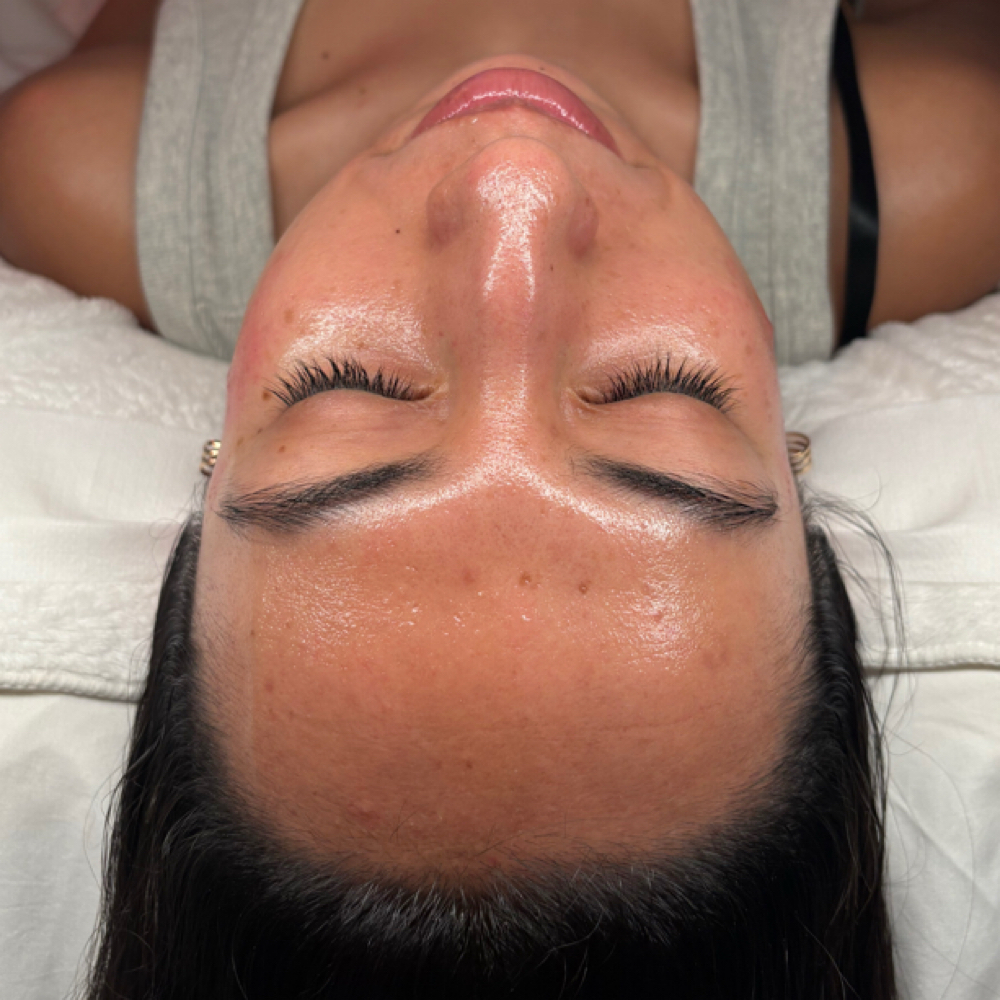 Nano Infusion Facial at Euphoria Skin in Chandler, AZ