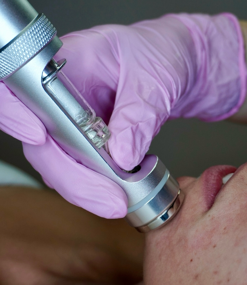 Electroporation Facial at Cora Esthetics in Lubbock, TX