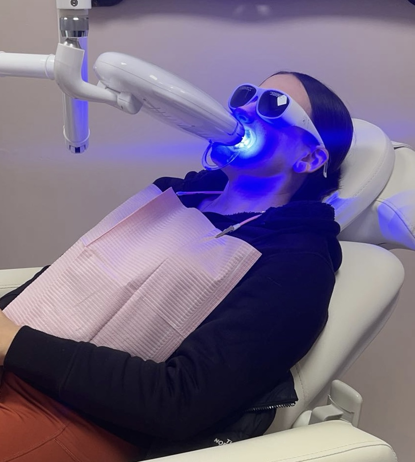Teeth Whitening