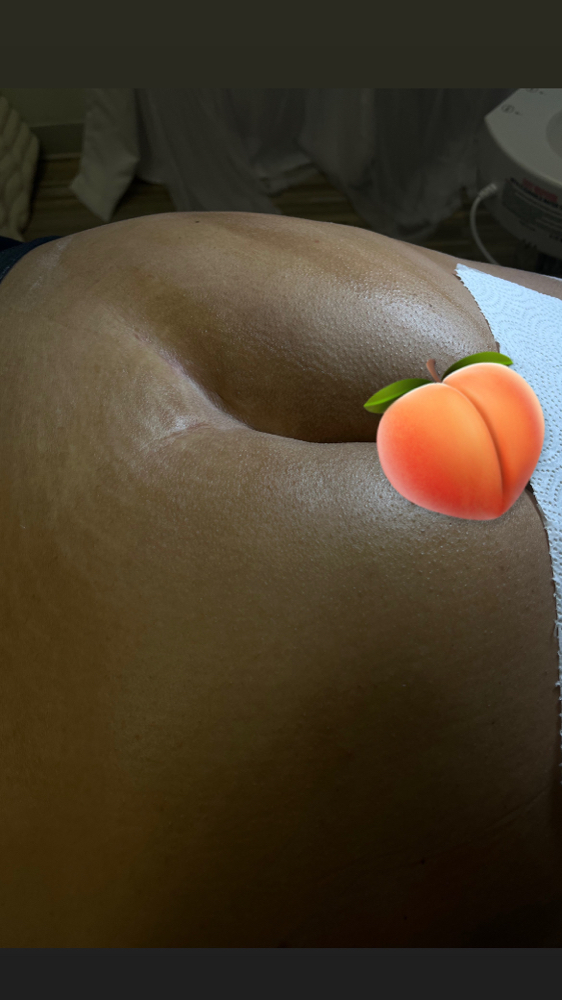 Full Butt