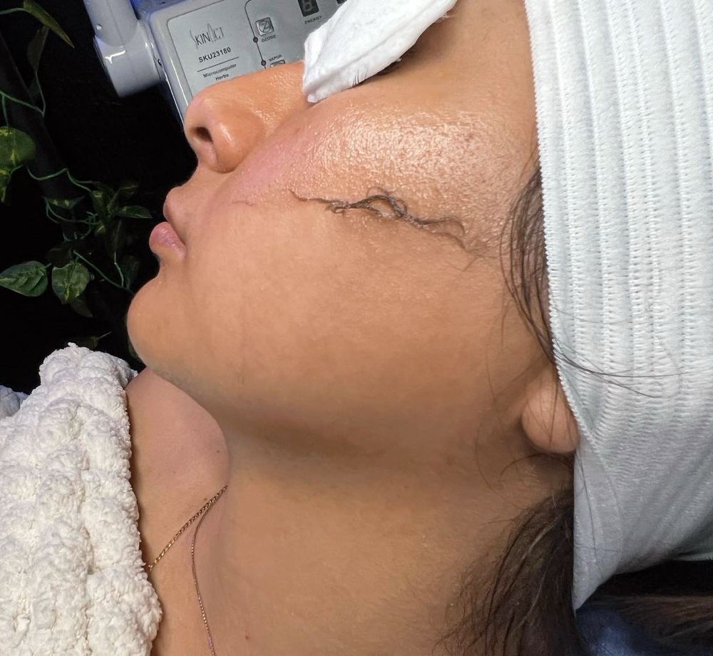 Dermaplane Signature Facial