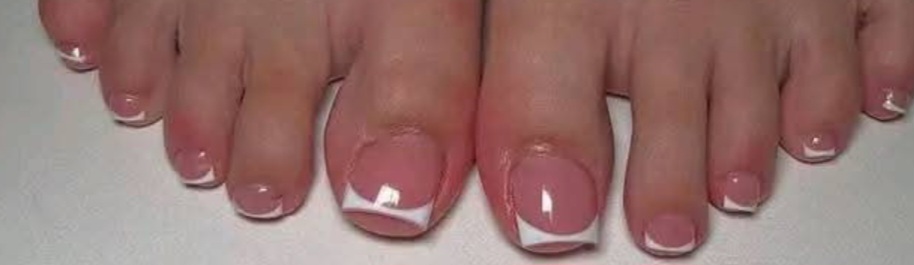 Acrylic On Big Toes Only