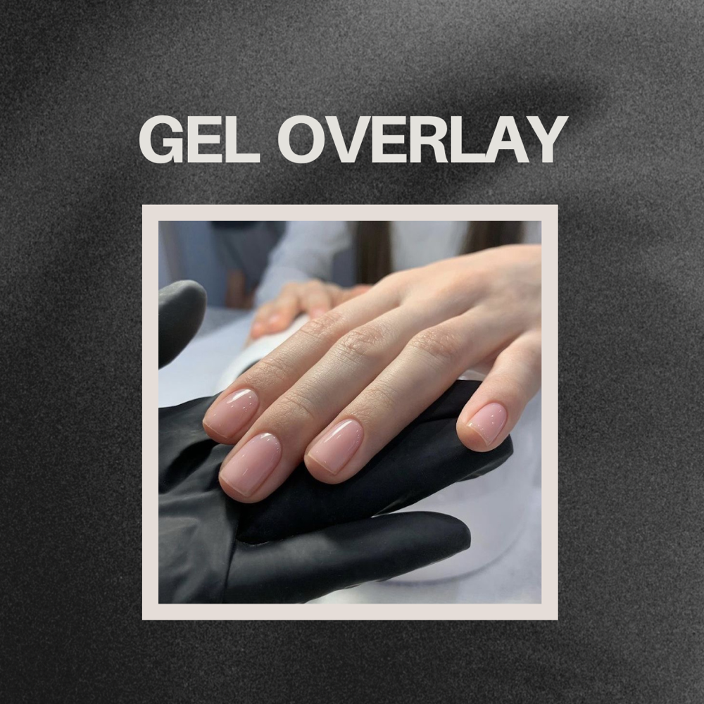 Gel Overlay