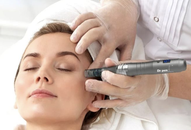 Microneedling