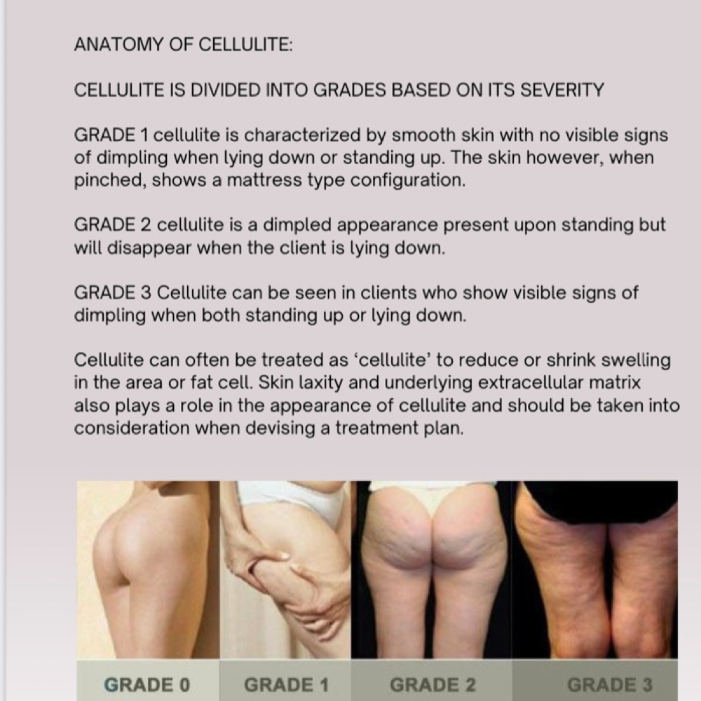 Cellulite Reduction Treatment at Lisa’s Lil Spa Room in Sioux Falls, SD