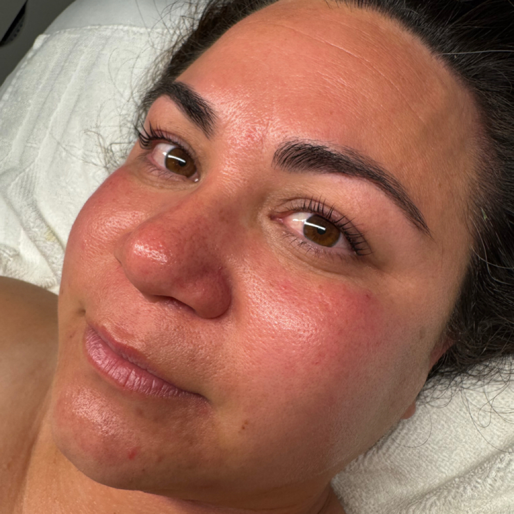 Mini Facial at Aesthetically You in Bakersfield, CA