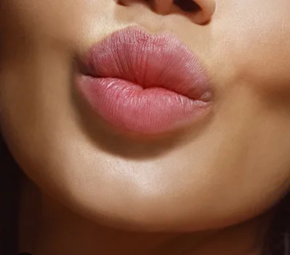 Mini Lip Pout: Filler + Tox at Belle Vie Aesthetics & Wellness in Pueblo, CO