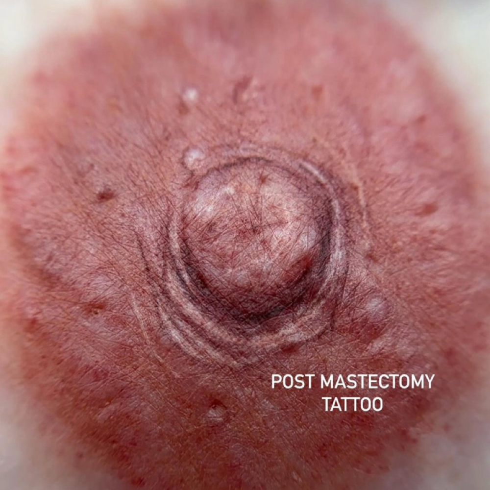 3D Areola at Kontour Aesthetics Studio in Alpharetta, GA