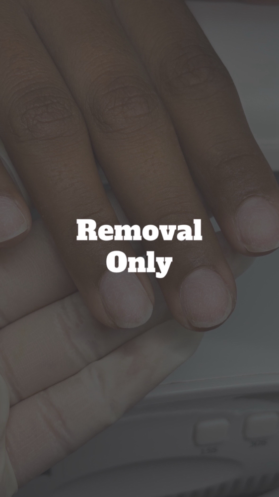 Removal Only