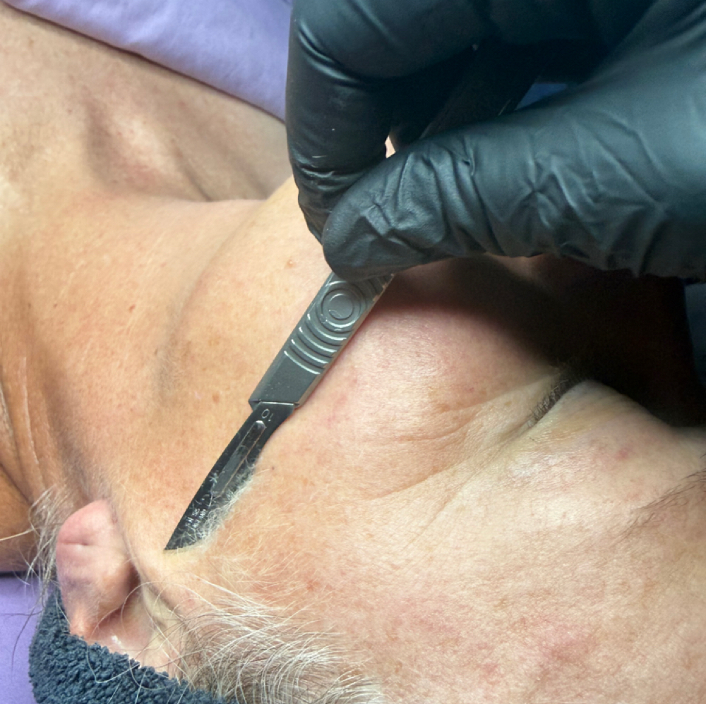 Dermaplane Facial Add-On at Alpenglow Esthetics in Nederland, CO