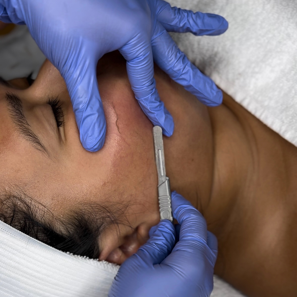 Luxe Dermaplane Facial