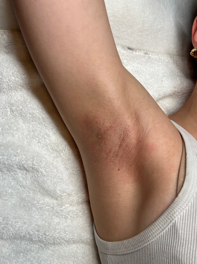 Underarm Wax at Ashlashbeauty in Akron, PA