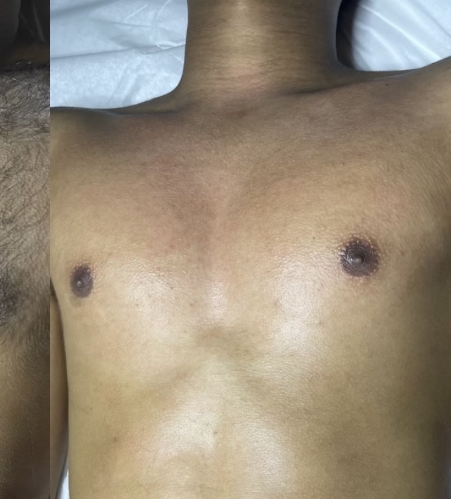 Mens Chest Sugar Wax