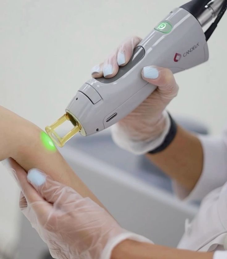 Laser Hair Removal- Medium Area