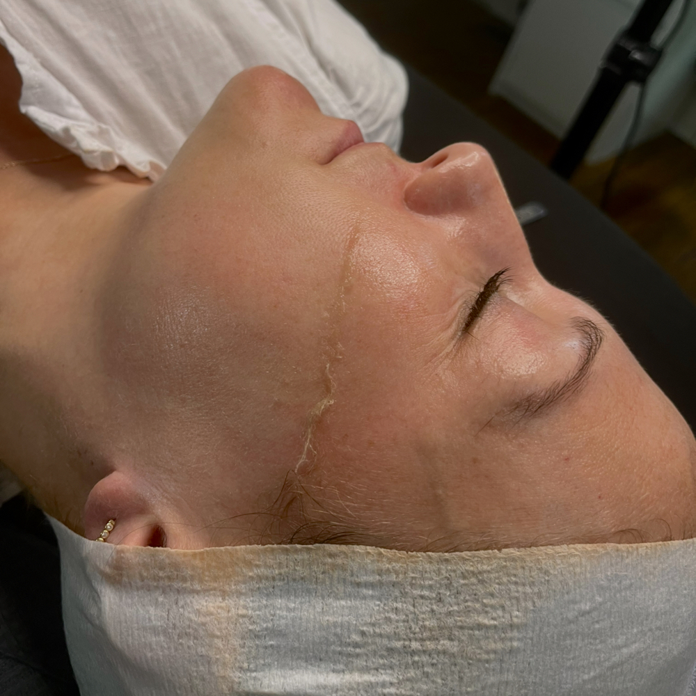 Dermaplaning Facial