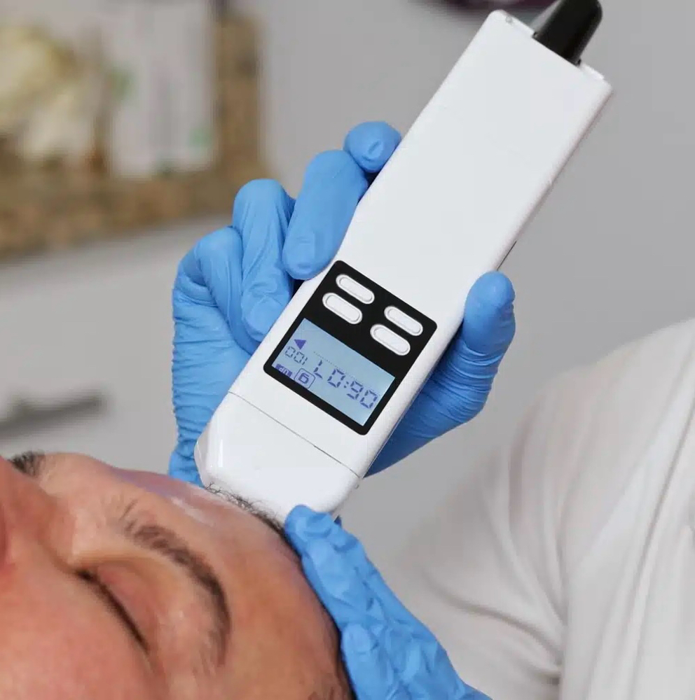 Ultimate Facial W/ Exo|e at KMDEsthetics in Columbus, MS