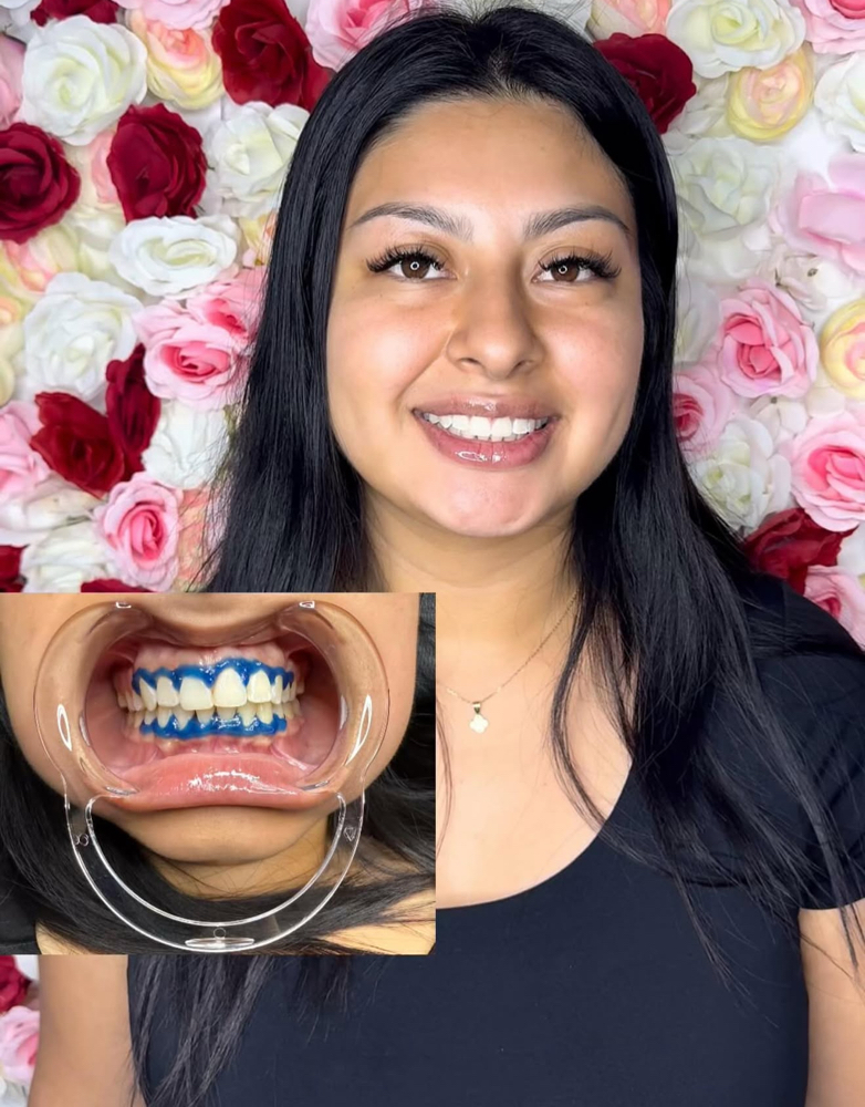 40Min (Basic/Subtle Refresh) at Luxe Glow Smiles in orlando, FL