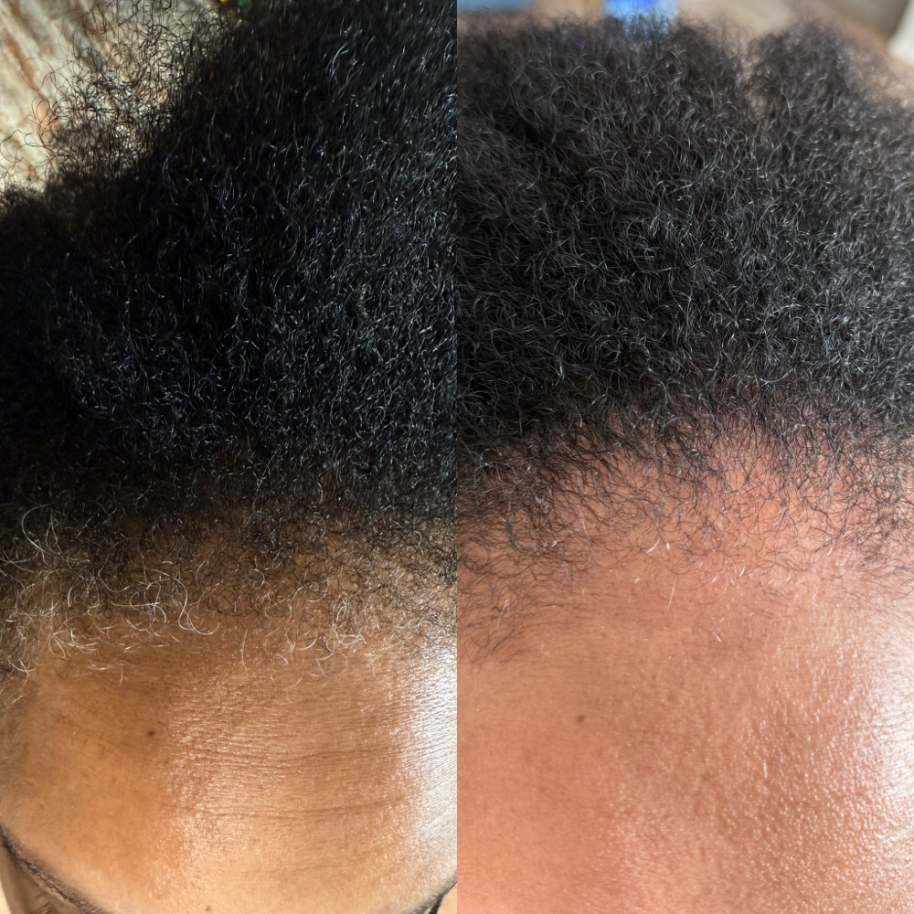 Front Color Touch-up