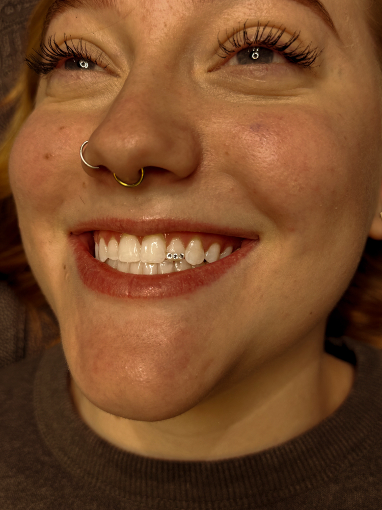 Teeth Whitening at Desert Gems in Reforge, UT