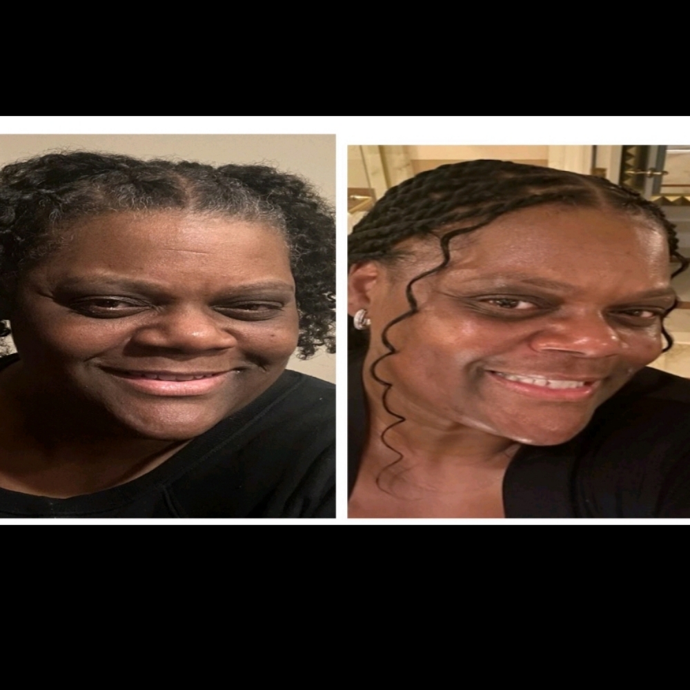 Chemical Peel- Consult Required at Skin Romance Spa And Beauty Lounge in Clifton Heights, PA