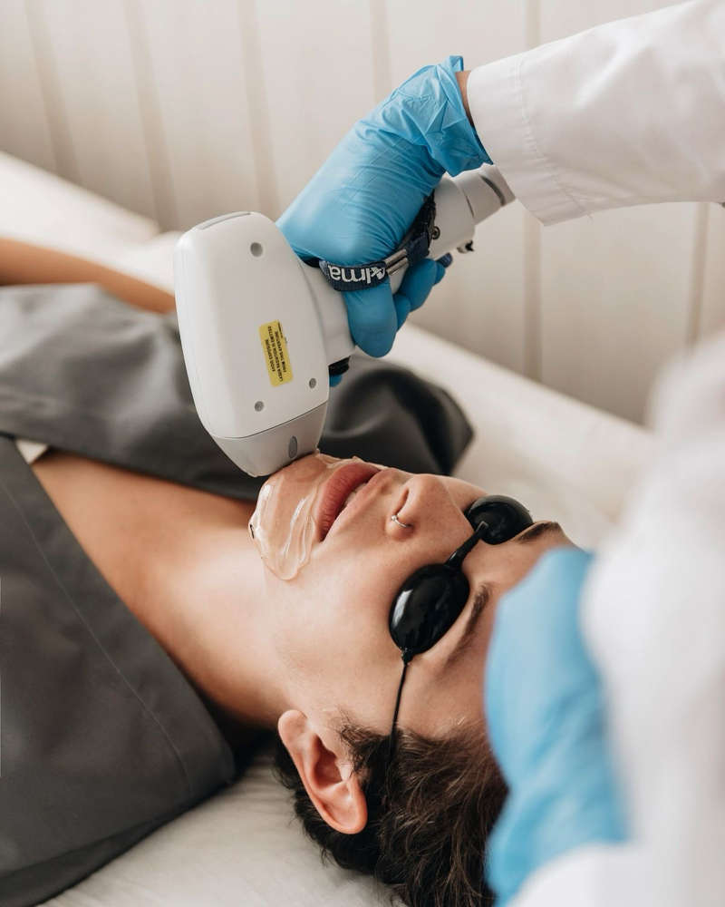 Laser Hair Removal-Face at Aurora Glow Aesthetics in Spring, TX
