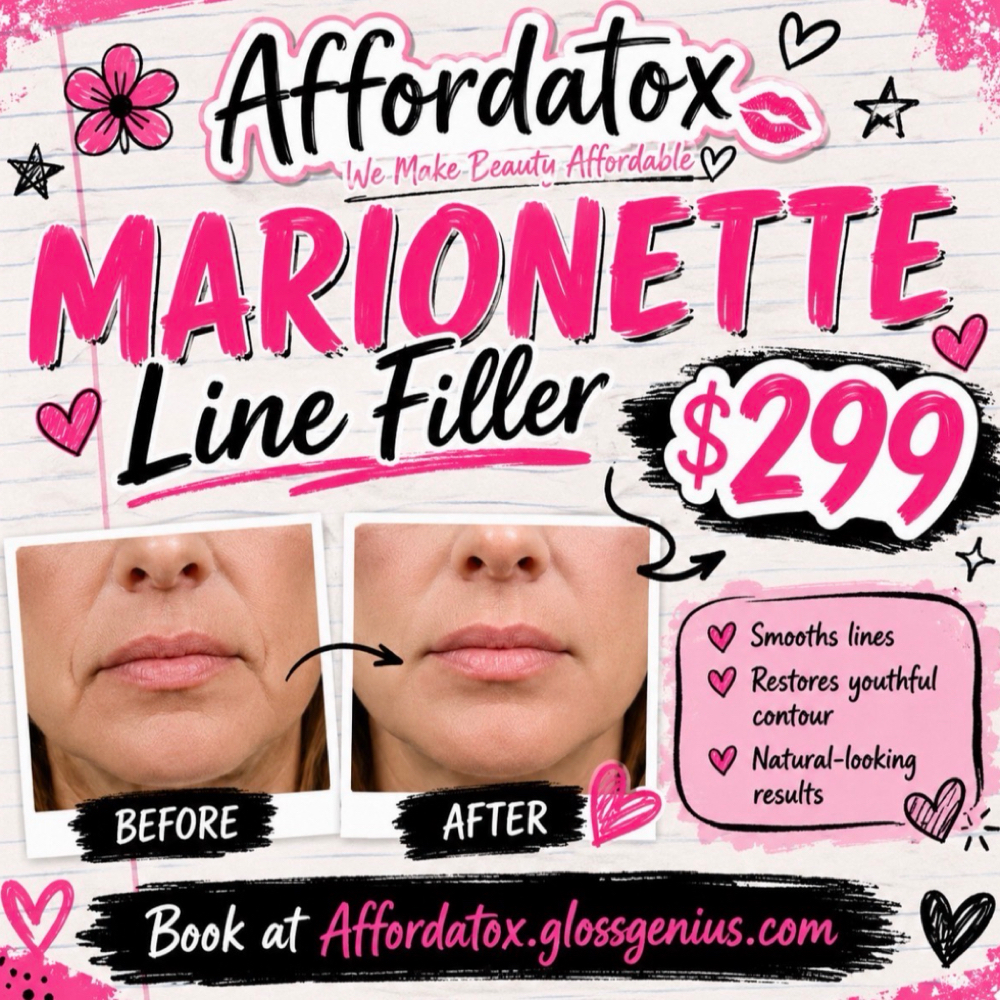 Marionette Line Filler at Affordatox in Middlesboro, KY
