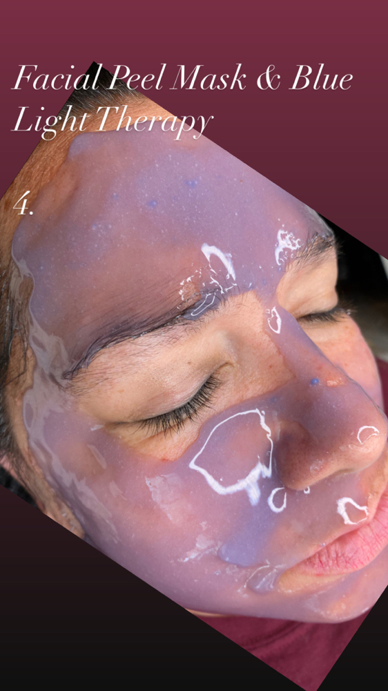 Acne Facial
