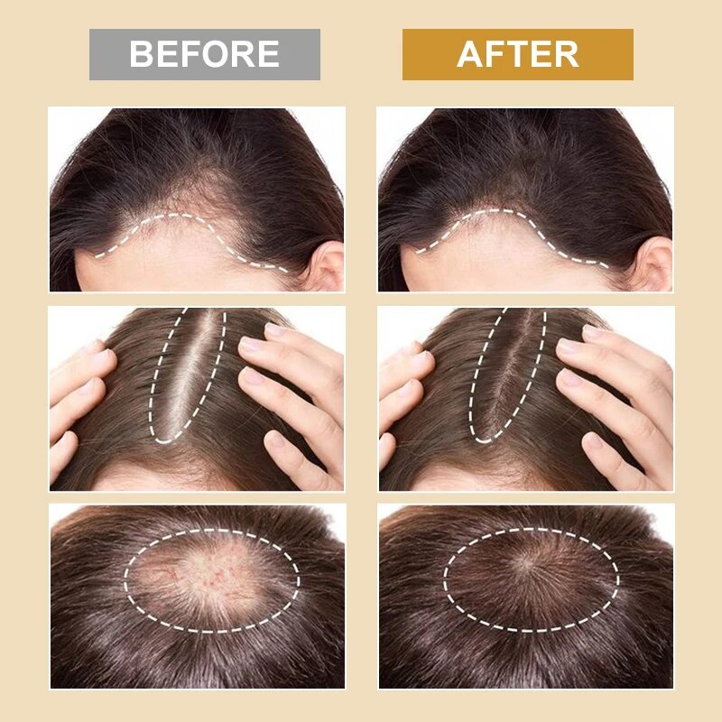 🌿 Exosome Hair Growth – 3 Sessions