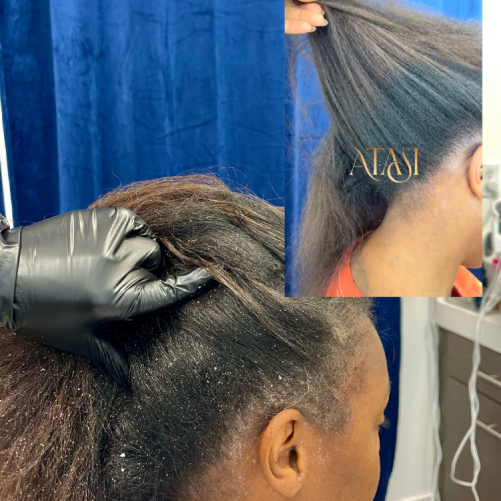 SEB DERM Scalp Revive at ATASI Head & Scalp Spa in Frisco, TX