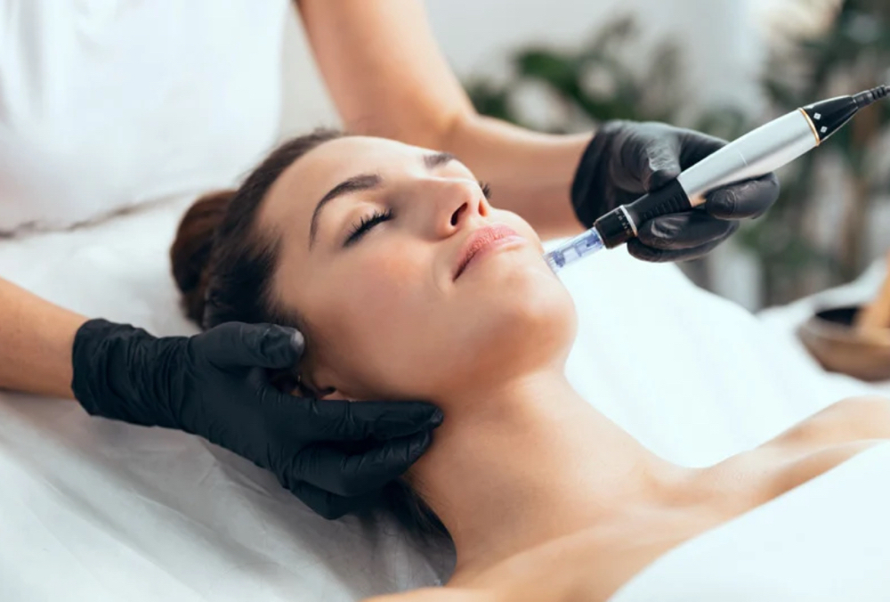 Microneedling Face And Neck at Sarah Stone Cosmetic Tattoo Clinic in Fontana, CA