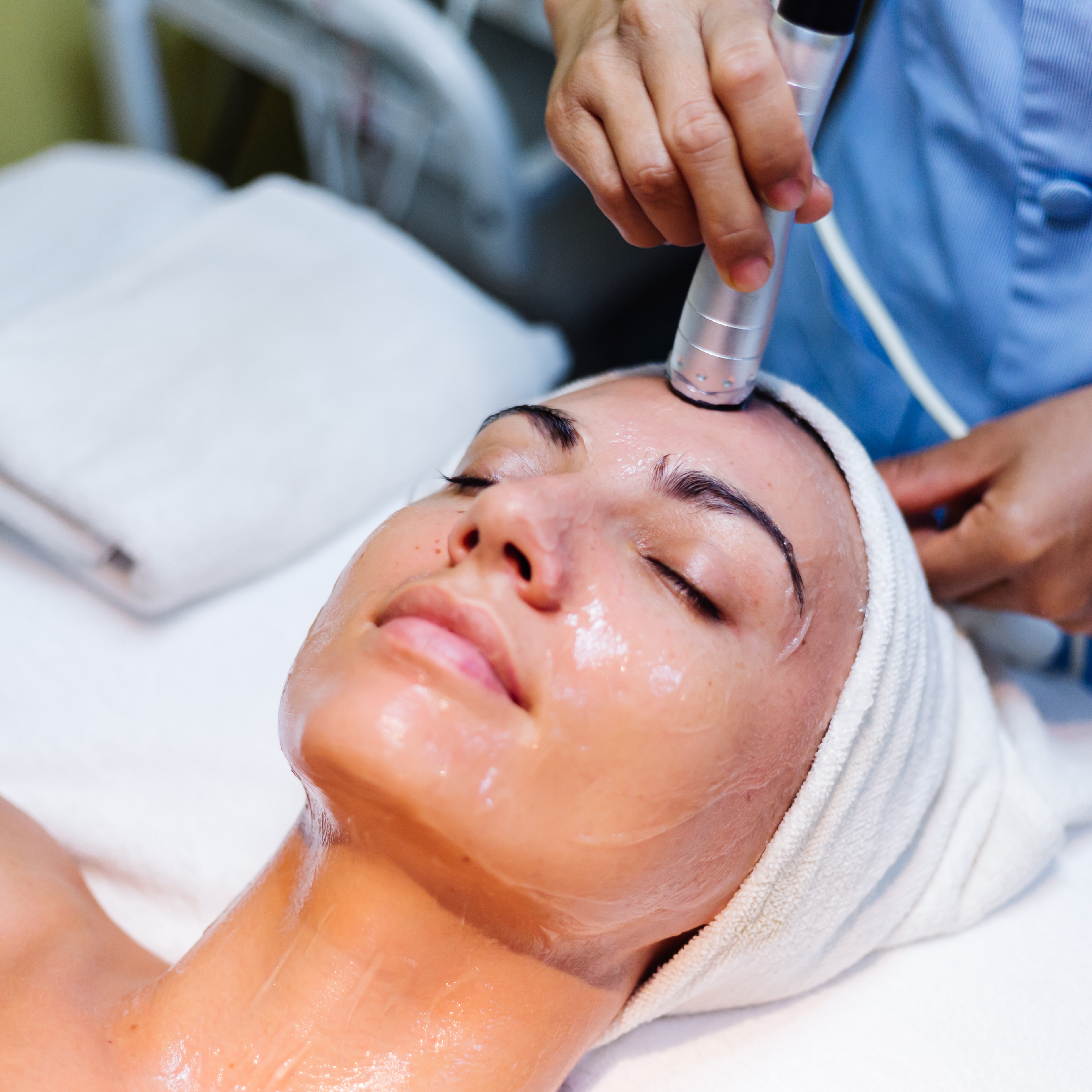 CryoFacial at Celtic Spa Laser Services in Attleboro, MA