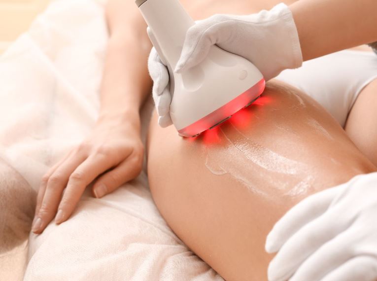 Cellulite Treatment