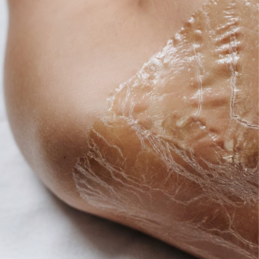 The Better Than Botox Facial