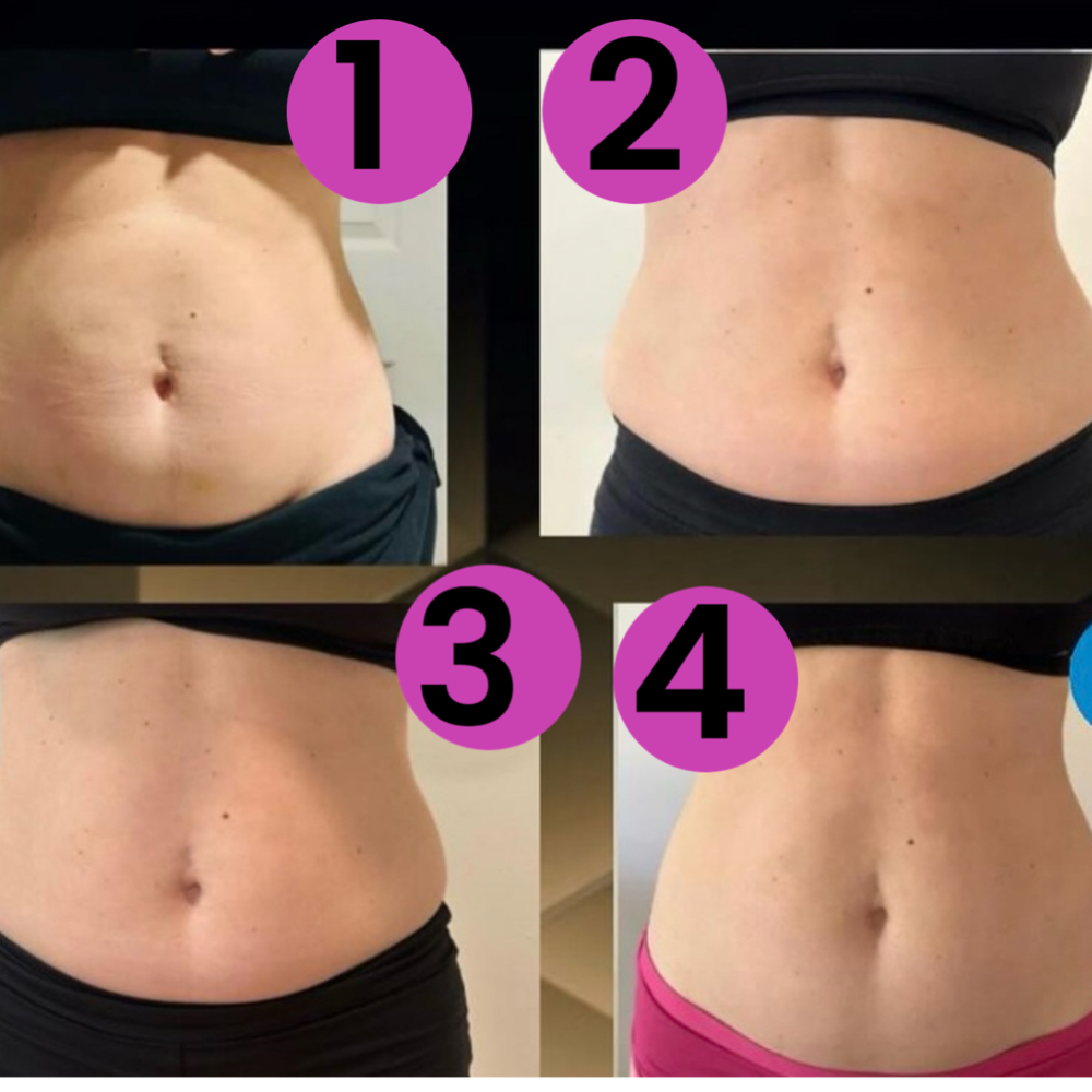 360 Slimming Package at Eula Skin in Dallas, TX