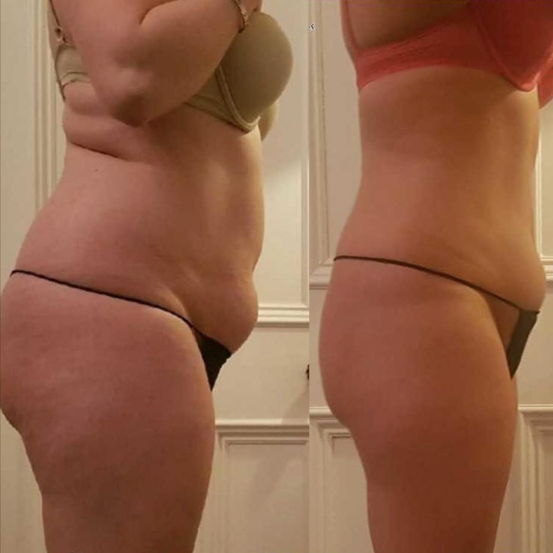 5 Slimming Package at Eula Skin in Dallas, TX