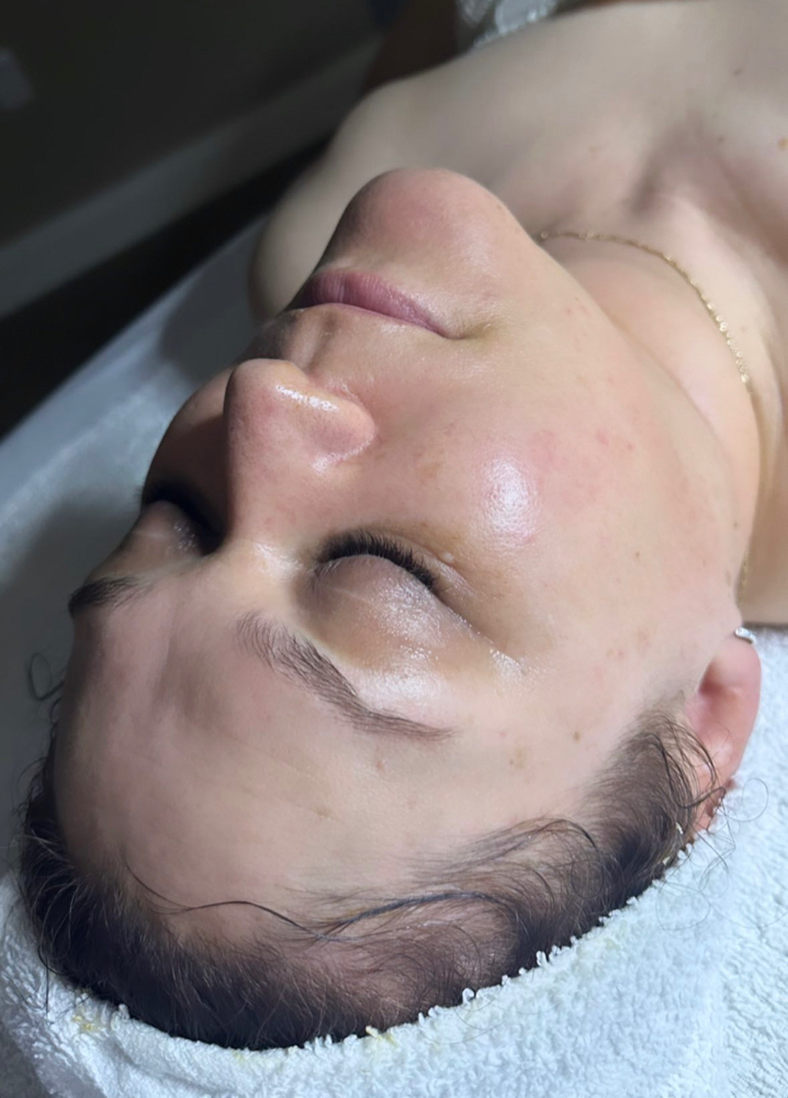 Glass Skin Oxygen Facial