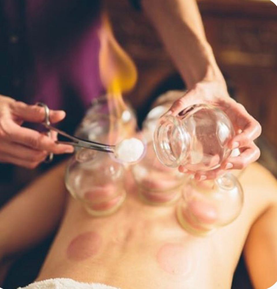 Cupping & Massage 1 1/2