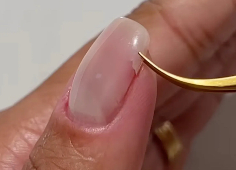 Nail Repair