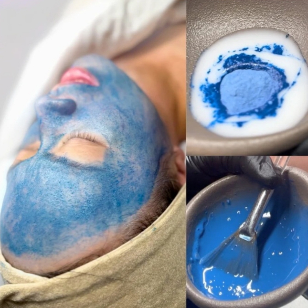 Blue Spicule Peel at Zen Glow Esthetics in Vancouver, WA