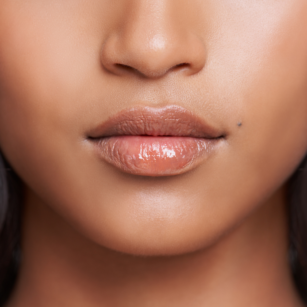 Upper lip