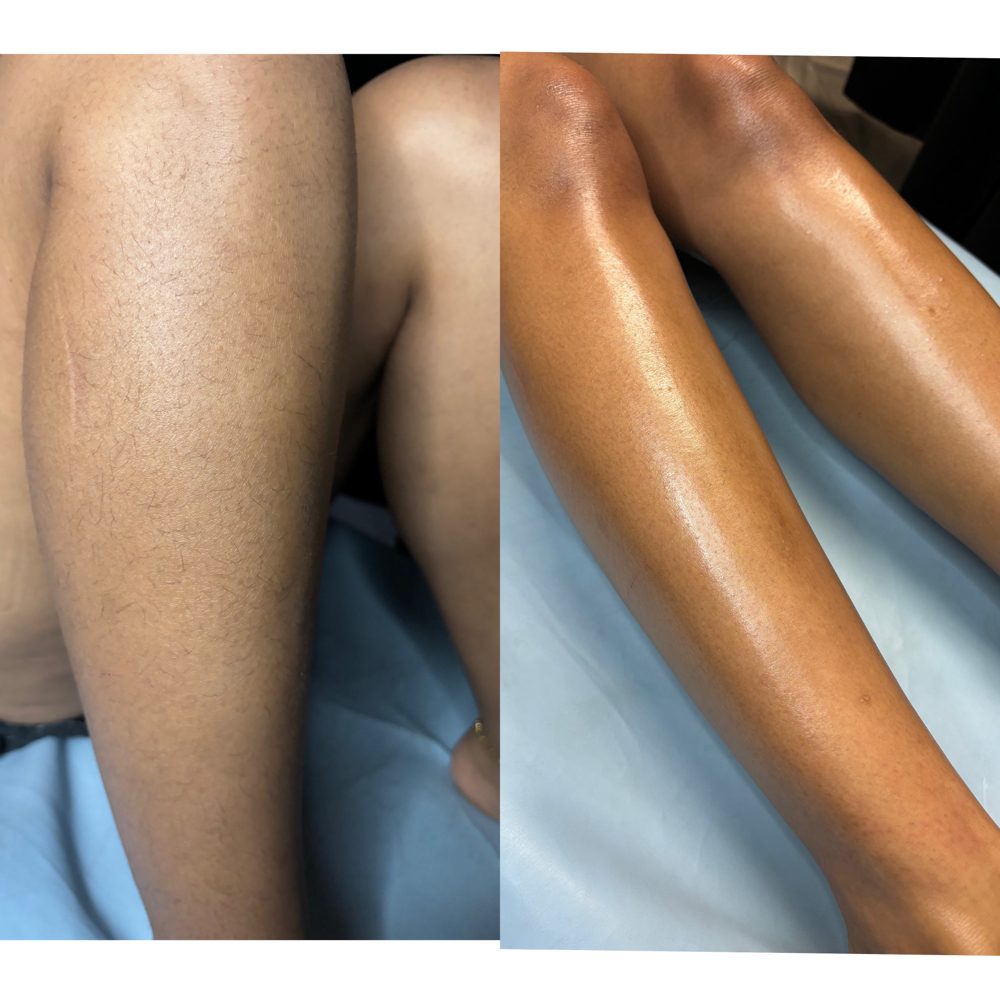 Full Leg Wax at ShoMeBeauty in Saint Joseph, MO