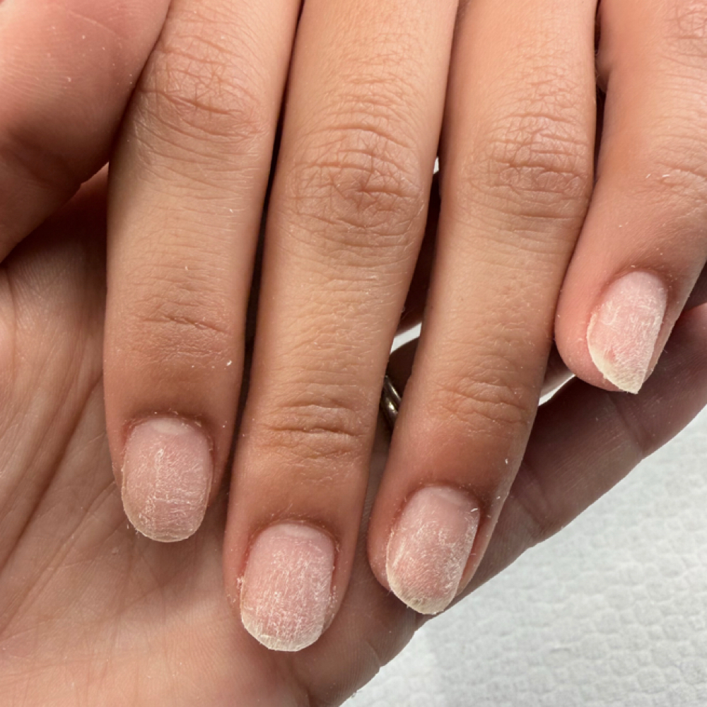 Foreign Removal w/out Service at Claws By Kim in Dayton, OH