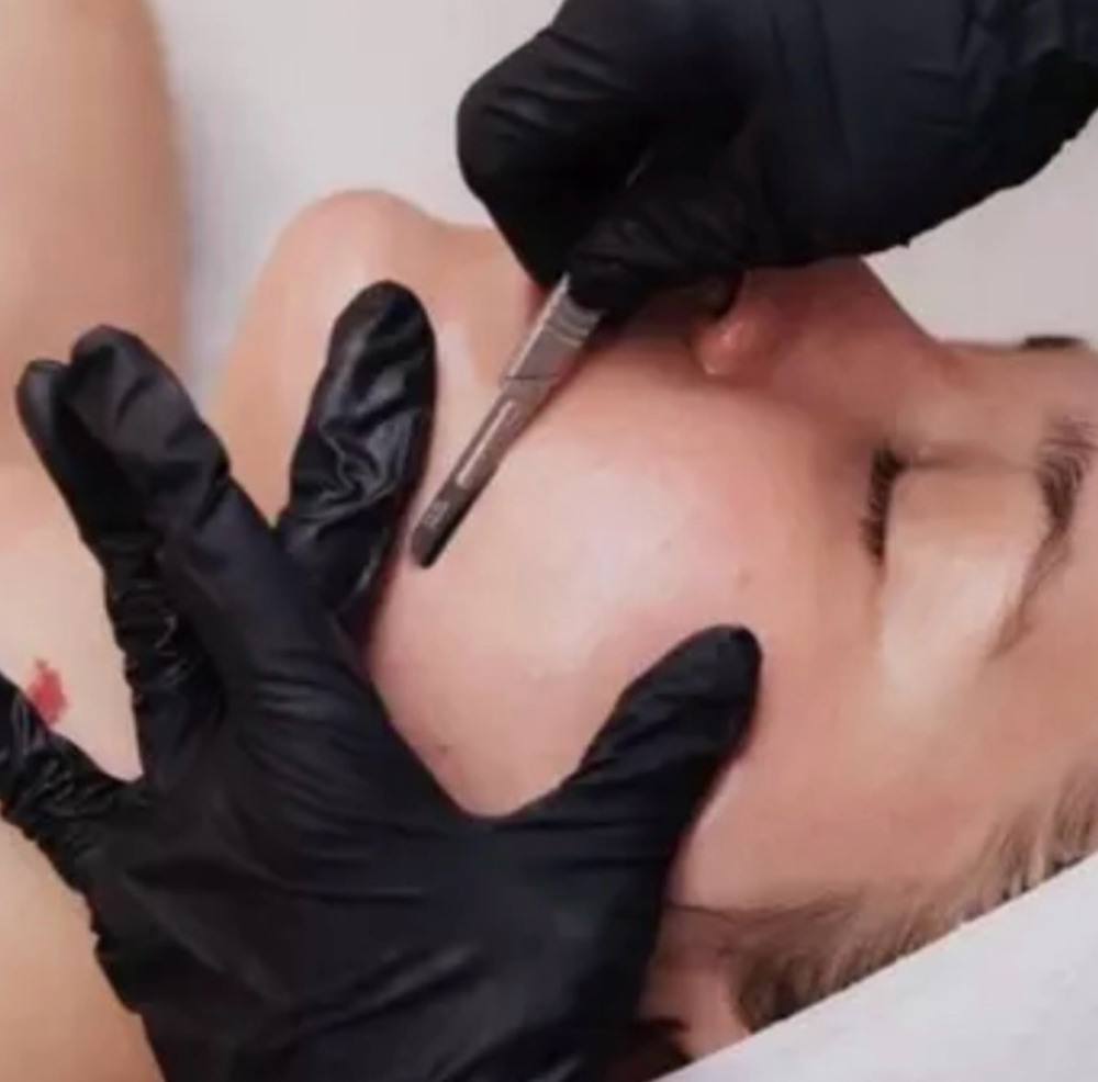 Dermaplaning Facial at Skin & Body by Milly in Casselberry, FL