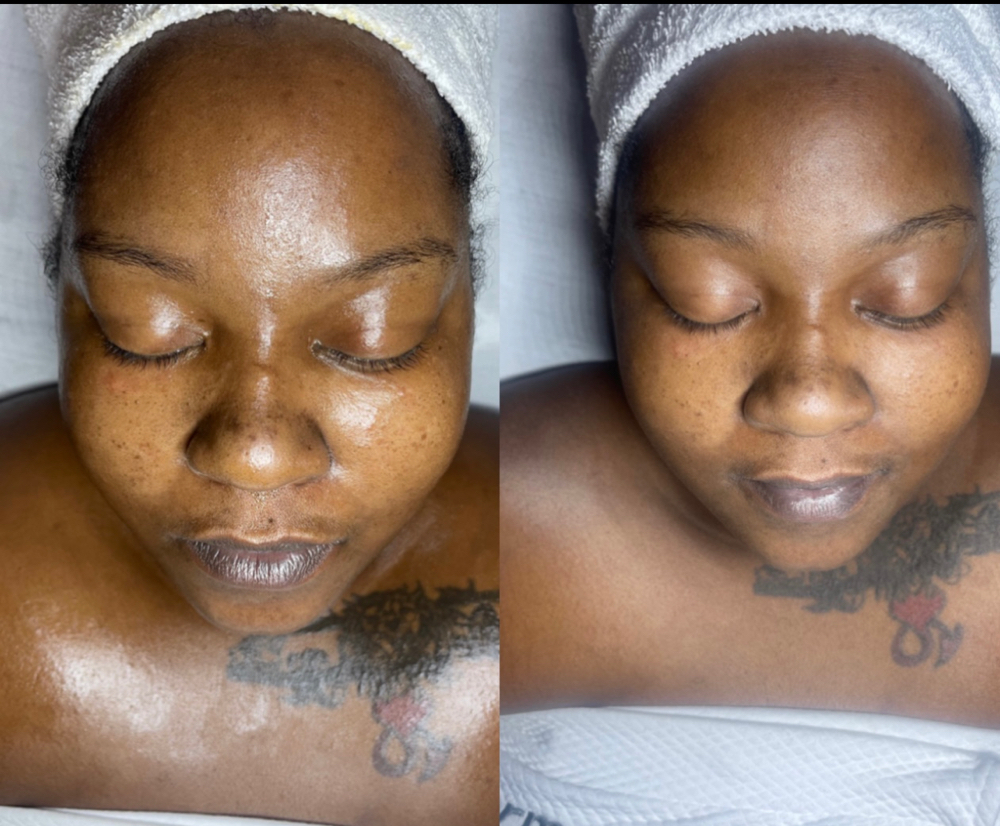 Princess Treatment(Basic Facial)