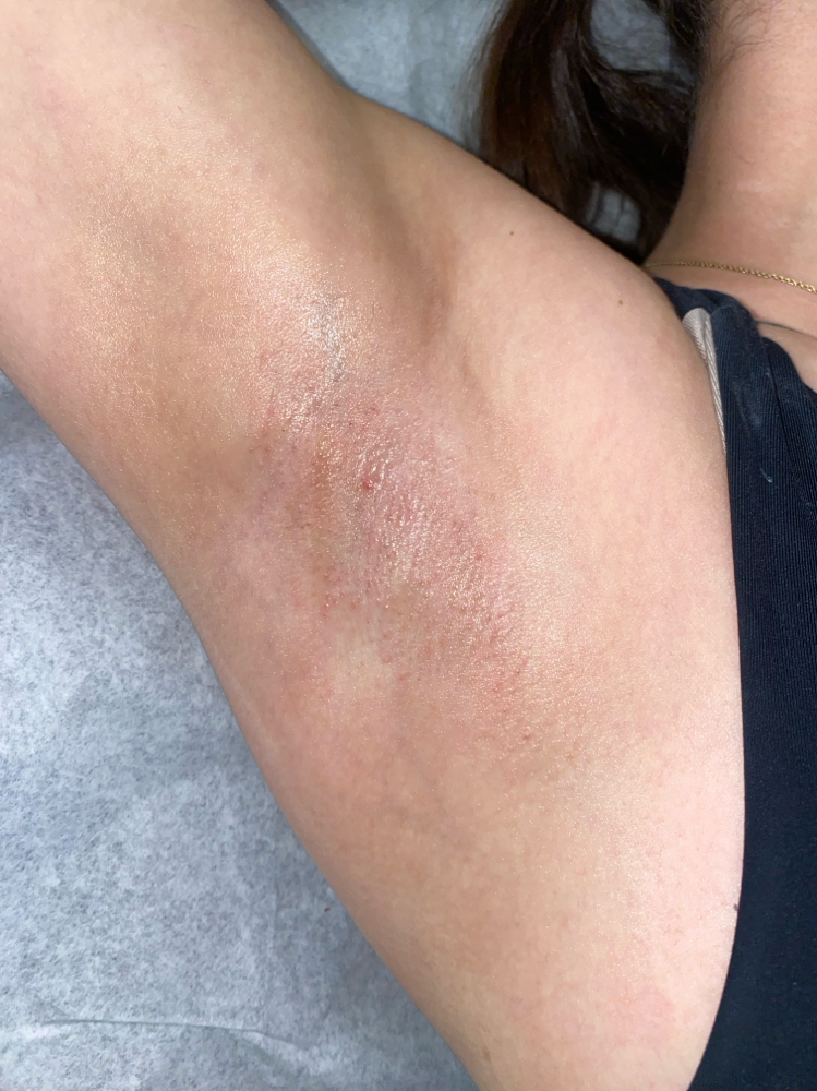 Under Arm Wax at Babysk.n in Loving, NM