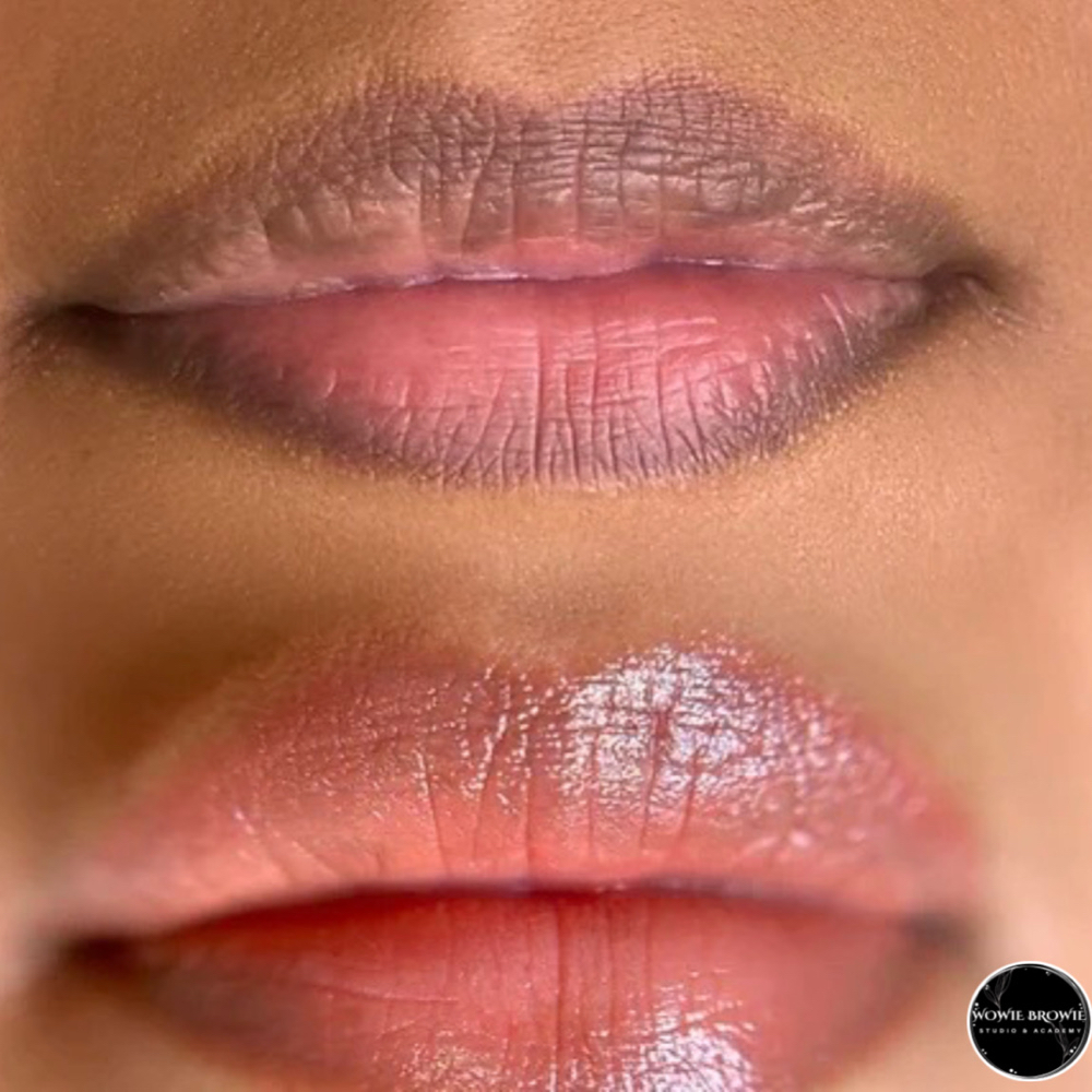 Dark Lip Neutralization