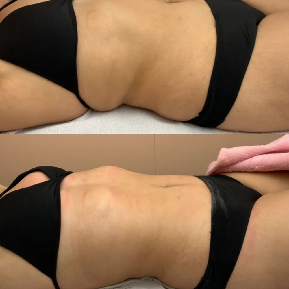 Platinum Face & Body Combo at Styled By Millie in Arlington, TX